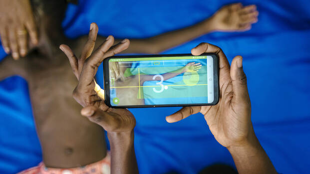 Untersuchung auf Mangelernährung mit der SAM-Foto-App Ein Kind wird mithilfe der SAM-Foto-App auf Mangelernährung untersucht.